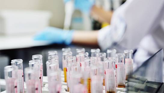 About half of pharma launches underperform versus targets